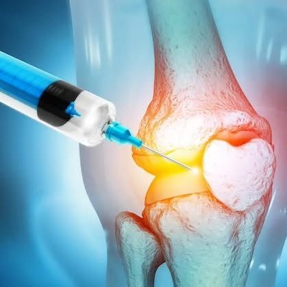 Doctor administering a joint injection to a patient's knee